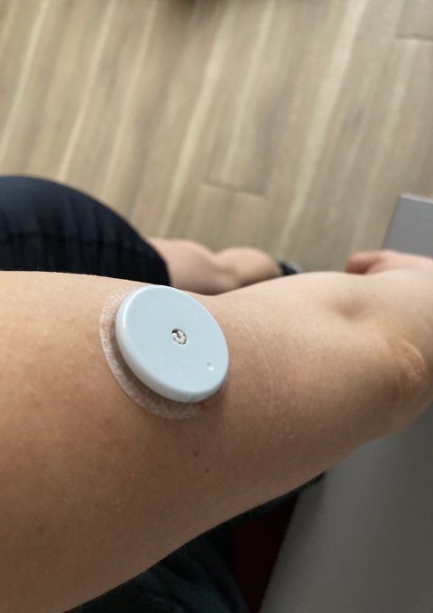 Ultrahuman Cyborg's Abbott CGM sensor shown worn on the upper arm